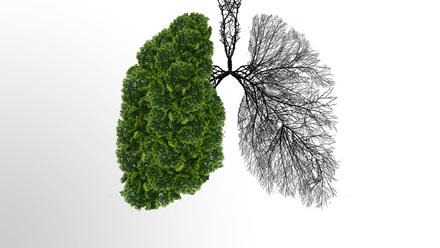 Respiratory Conditions