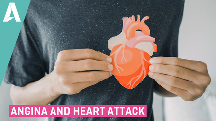 Angina and Heart Attack