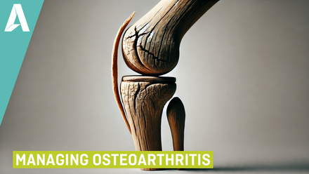 Managing Osteoarthritis